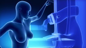 Mammography concept